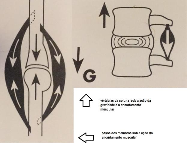 Compressão das Vertebras