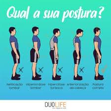 Qual a Postura Correta? Retificação Lombar, Hiperlordose Lombar, Hipercifose Dorsal, Anteriorização da Cabeça, POSTURA CORRETA